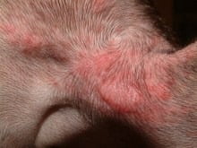 dermatopathia